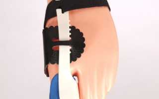 Ортопедические вальгусные шины для косточки на ноге