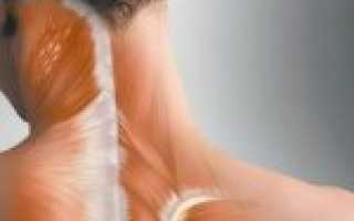 Причины возникновения спазма мышц шеи и способы его лечения