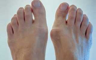 Болит и опухает палец на ноге — причины и способы лечения